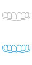 Invisalign (Click)